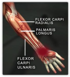 4fde4a7ae4b0f2662fd349f8-agentx5-1340024160132-hand_flexors